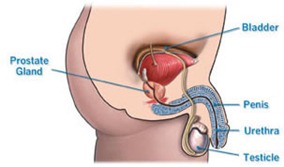 Top NYC Urologist Benign Prostatic Hyperplasia BPH 02