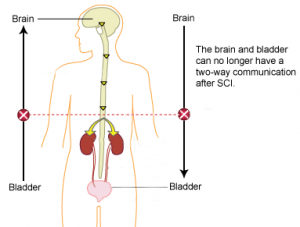 Neurogenic Bladder: Symptoms, Diagnosis & Treatment - Urology Care
