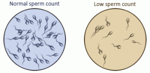 Abnormal Sperm Count